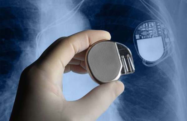 Electronic Pacemaker