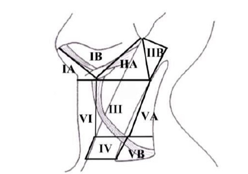 Diagrammatic representation of lymph node levels in the neck