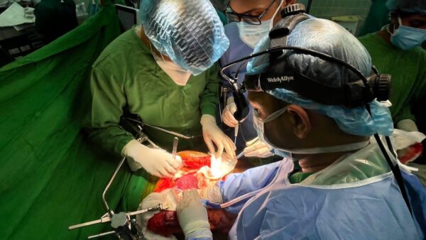 First Liver Transplant at J’pura Hospital