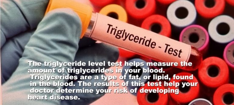 Why should you keep your blood triglycerides within the normal range when you are having diabetes?-By Dr Harold Gunatillake