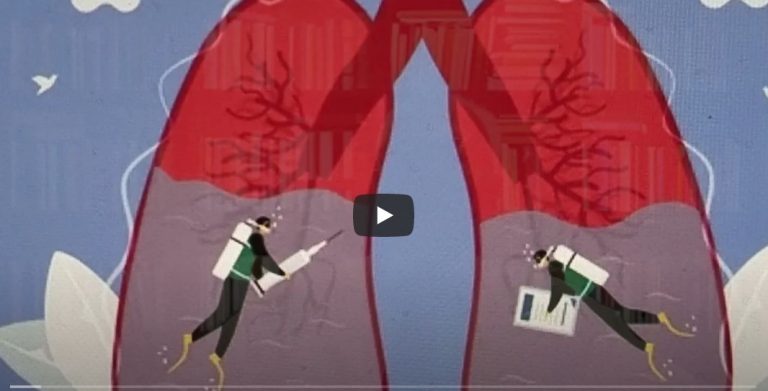 Leg swelling an early symptom of Heart Failure-By Dr Harold Gunatillake