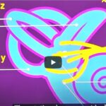 Positional Vertigo-Balance problem