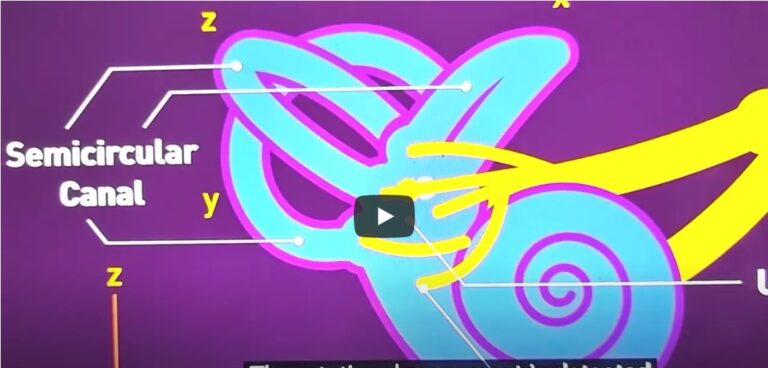 Positional Vertigo-Balance problem-by Harold Gunatillake