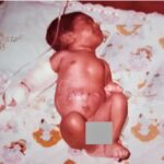 infant-c-scaled