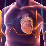 Calcified arteries- what is the significance - eLanka