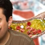 U.S. Government takes U-turn on Cholesterol