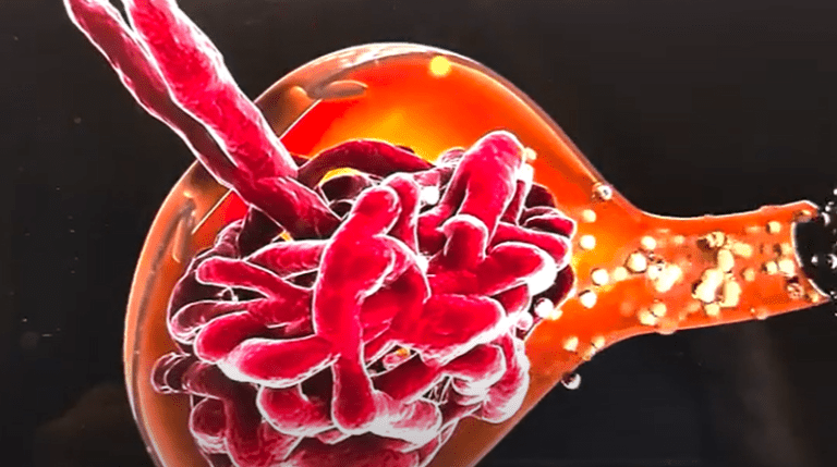 What is the significance of eGFR? – By Dr harold Gunatillake