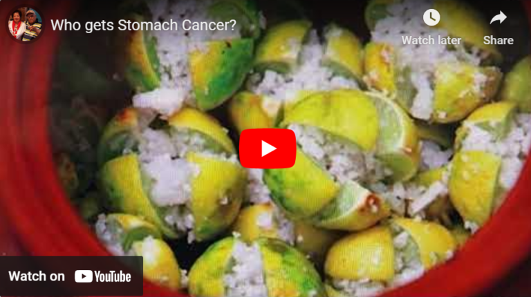 Who gets stomach cancer? – By  Dr harold Gunatillake