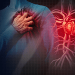 heart attack