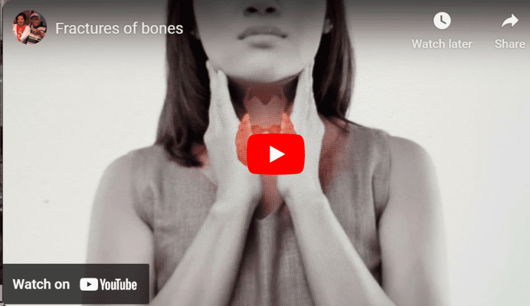 Osteoporosis among Sri Lankan women – By Dr harold Gunatillake