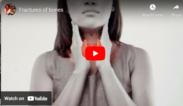 osteoporosis