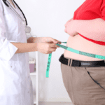 Obesity and potbelly - eLanka