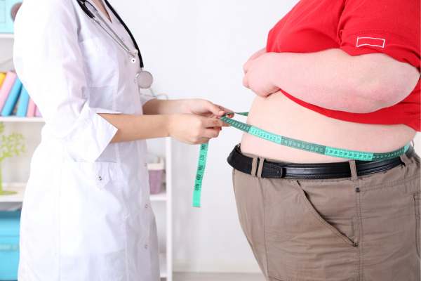 Obesity and potbelly - eLanka