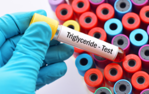 Triglycerides can harm your body. – By Dr Harold Gunatillake