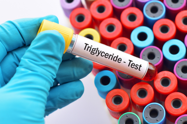 Triglycerides