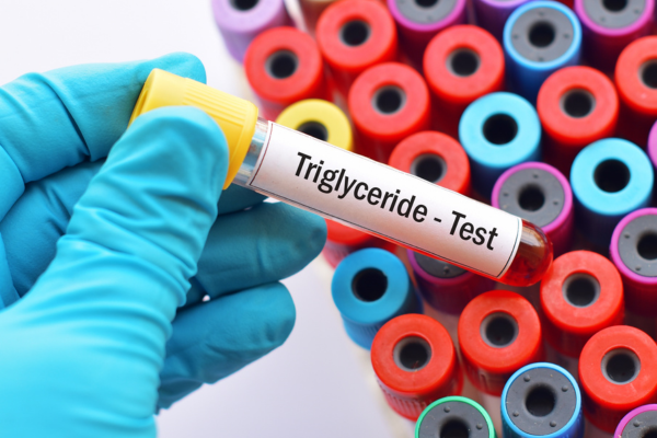 Triglycerides can harm your body. – By Dr Harold Gunatillake