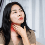 Lymph Nodes