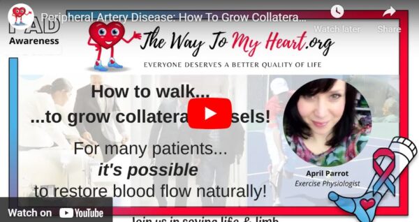 Peripheral Artery Disease: How To Grow Collateral Vessels by Walking