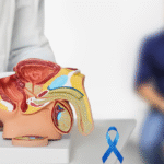 Prostate Cancer Treatment