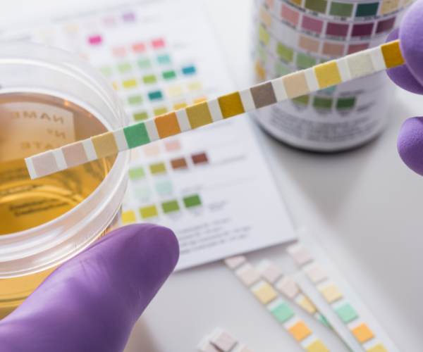 Foamy Urine Causes and Remedies – Dr. Harold Gunatillake | eLanka Health Insights